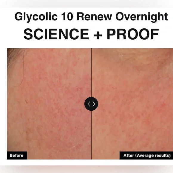 Glycolic 10 Renew Overnight by SkinCeuticals (B3) - Picture 5 of 10